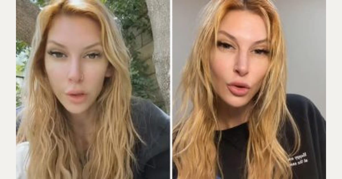 Πρώην πρωταγωνίστρια ερωτικών ταινιών αποκαλύπτει τα μυστικά του χώρου: «Αποσυνδεόμουν»